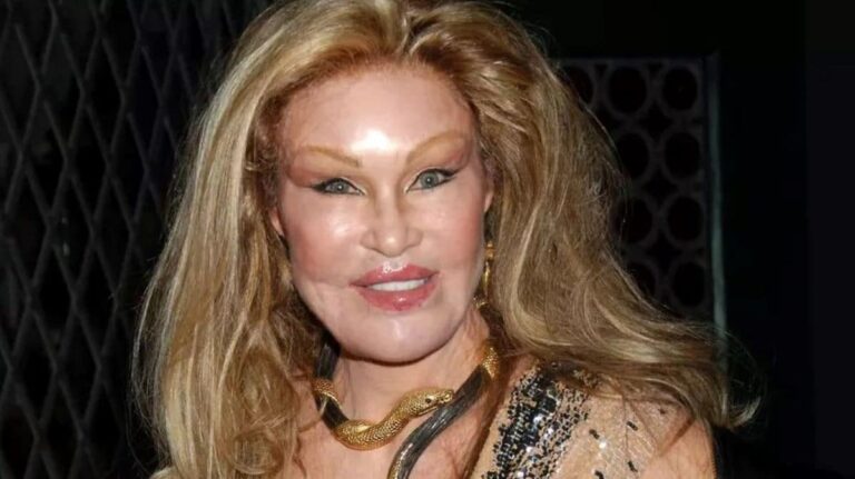 Lion Lady Plastic Surgery: An American Socialite Disputes Having ...