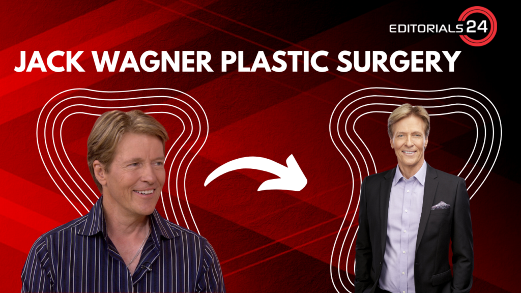 jack wagner plastic surgery