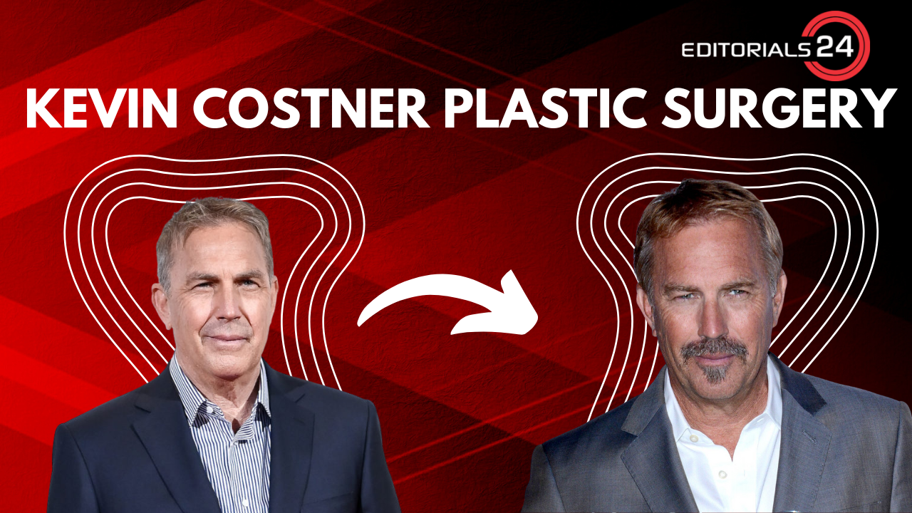 kevin costner plastic surgery