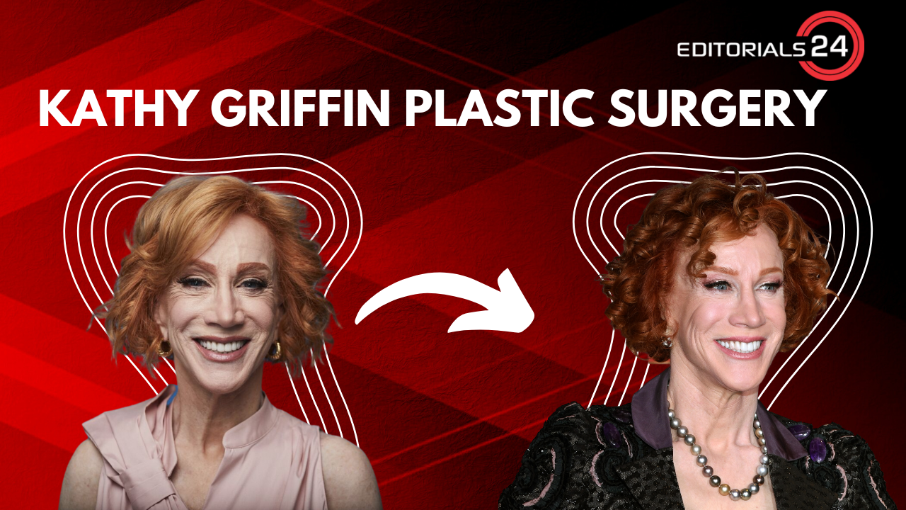 kathy griffin plastic surgery