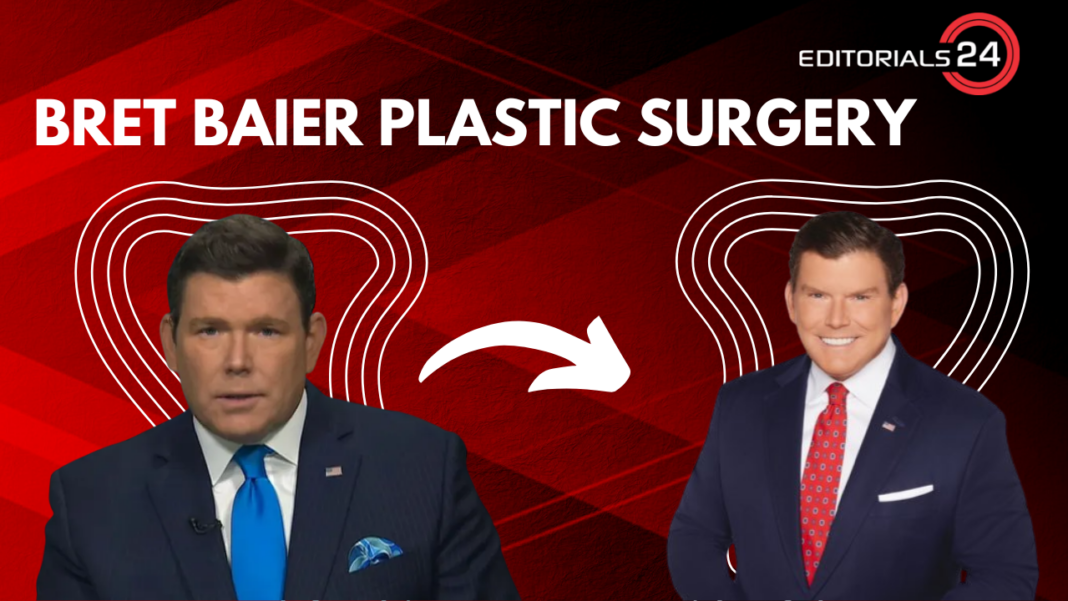 Bret Baier Plastic Surgery What Actually Happened To Bret Baier S Face