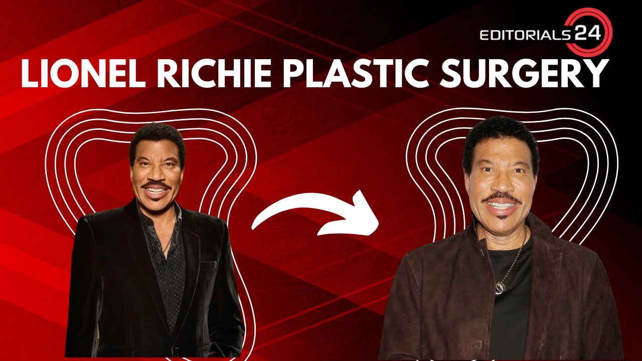 lionel richie plastic surgery